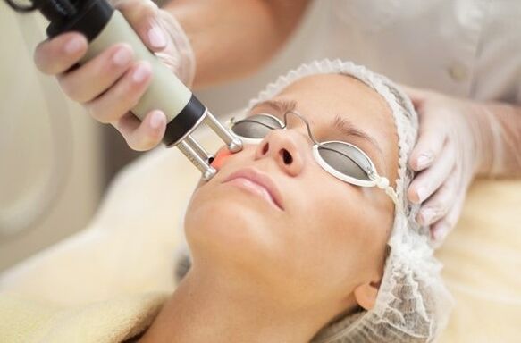 Thermische blootstelling aan epidermis